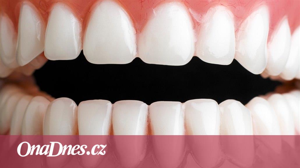 Ako sa prejavuje alergia na porcelánové zuby s kovom